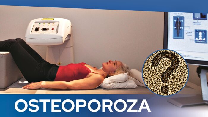 Fragment plakatu z leżącą na medycznej leżance kobietą, która jest poddawana badaniu. Pod spodem napis "osteoporoza".